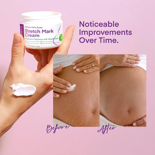 Stretch Mark Cream