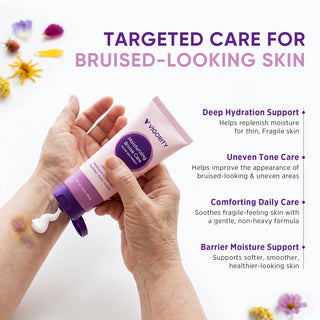 Arnica Bruise Cream for Thin & Mature Skin