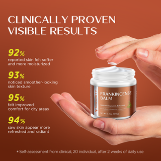Frankincense Balm