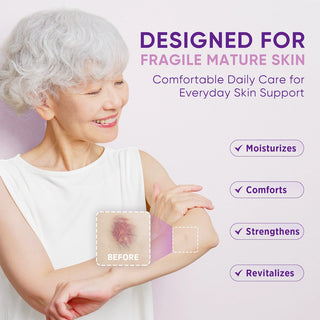 Arnica Bruise Cream for Thin & Mature Skin
